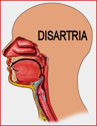 disartria-portada-01